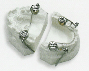 Herbst - Orthodontics