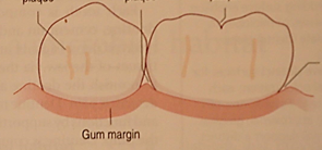 periodontal